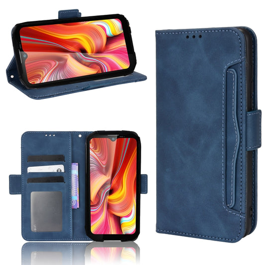 For Doogee S96 Pro Skin Feel Calf Pattern Leather Phone Case(Blue) - Doogee Cases by buy2fix | Online Shopping UK | buy2fix