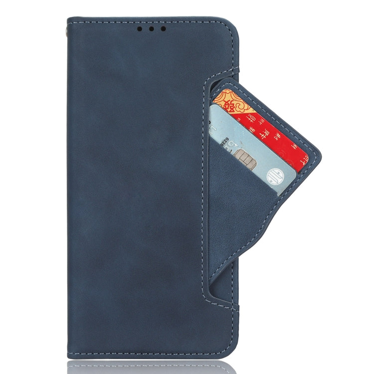 For Sony Xperia 1 VI 2024 Skin Feel Calf Texture Card Slots Leather Phone Case(Blue) - Sony Cases by buy2fix | Online Shopping UK | buy2fix