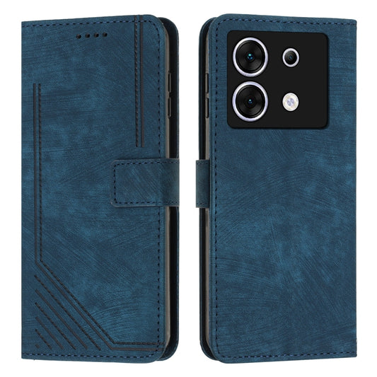 For Infinix Zero 30 5G Skin Feel Stripe Pattern Leather Phone Case with Lanyard(Blue) - Infinix Cases by buy2fix | Online Shopping UK | buy2fix