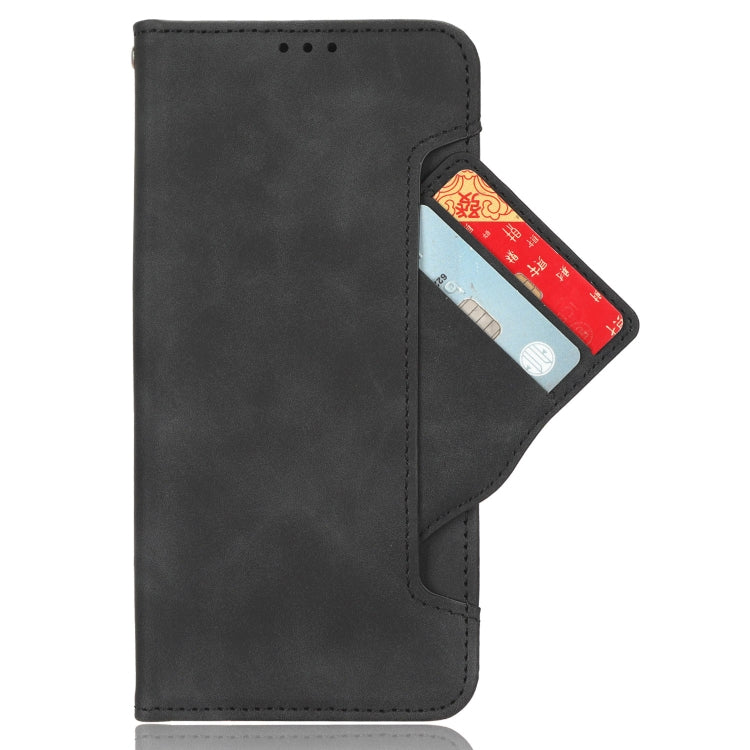 For Huawei nova 11 Skin Feel Calf Texture Card Slots Leather Phone Case(Black) - Ulefone Cases by buy2fix | Online Shopping UK | buy2fix